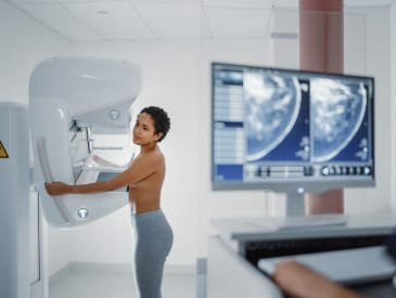 Computer Screen in Hospital Radiology Room: Beautiful Multiethnic Young Woman Standing Topless Undergoing Mammography Screening Procedure. Screen Showing the Mammogram Scans of Dense Breast Tissues.